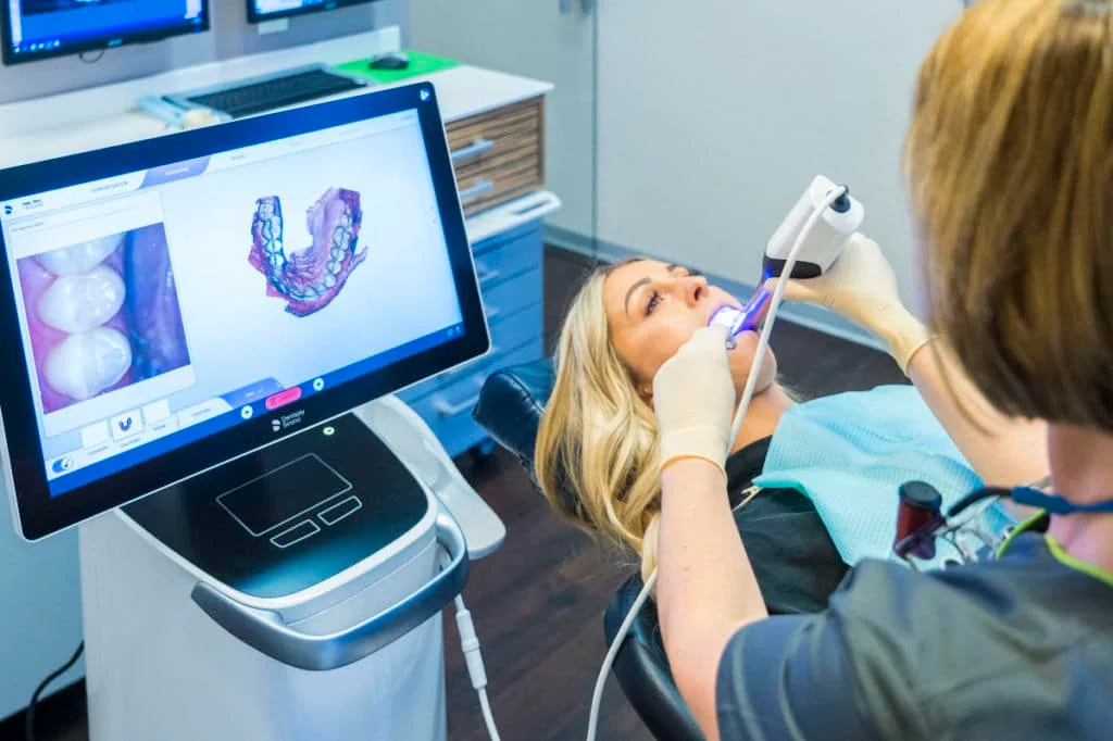 cerec 3d scan 1200 1024x682 1