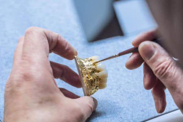 Veneers als alternative Methode für ästhetischen Zahnersatz in Köln